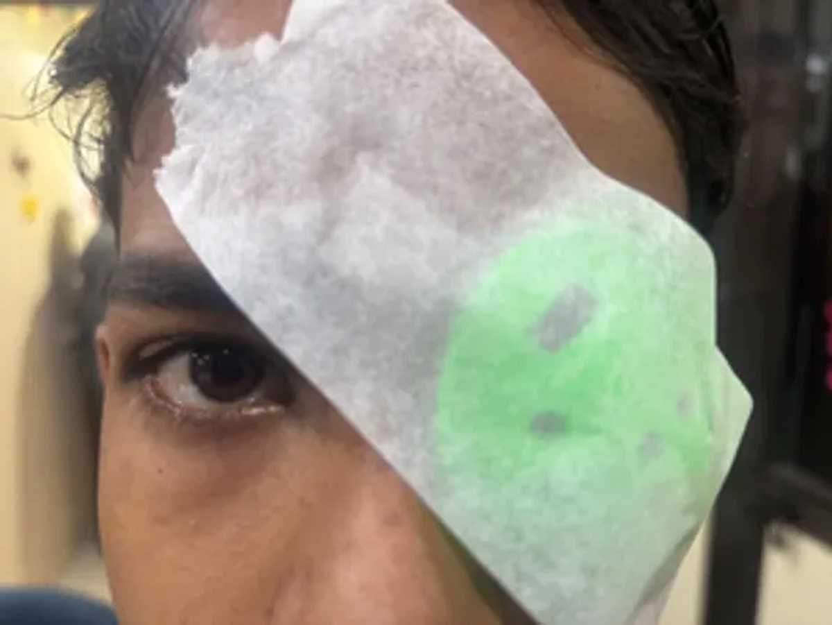 पीजीआई चंडीगढ़ में पहुंचे आतिशबाजी में घायल 21 मरीज